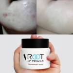 [BELLA LUCE] Cream to even skin tone and take care of melasma Bella Luce Root Of Miracle